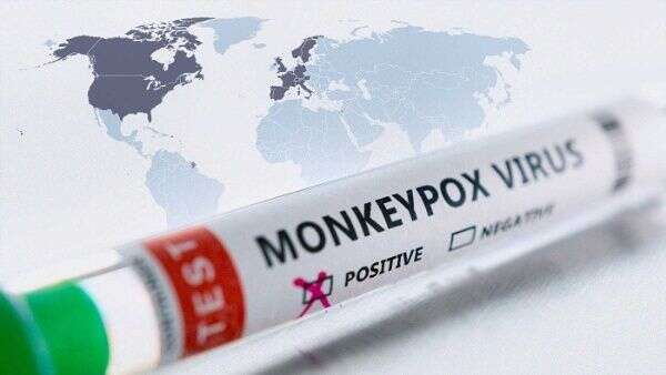 monkeypox vírus